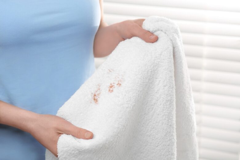 Woman,Holding,Terry,Towel,With,Makeup,Spot,Indoors,,Closeup